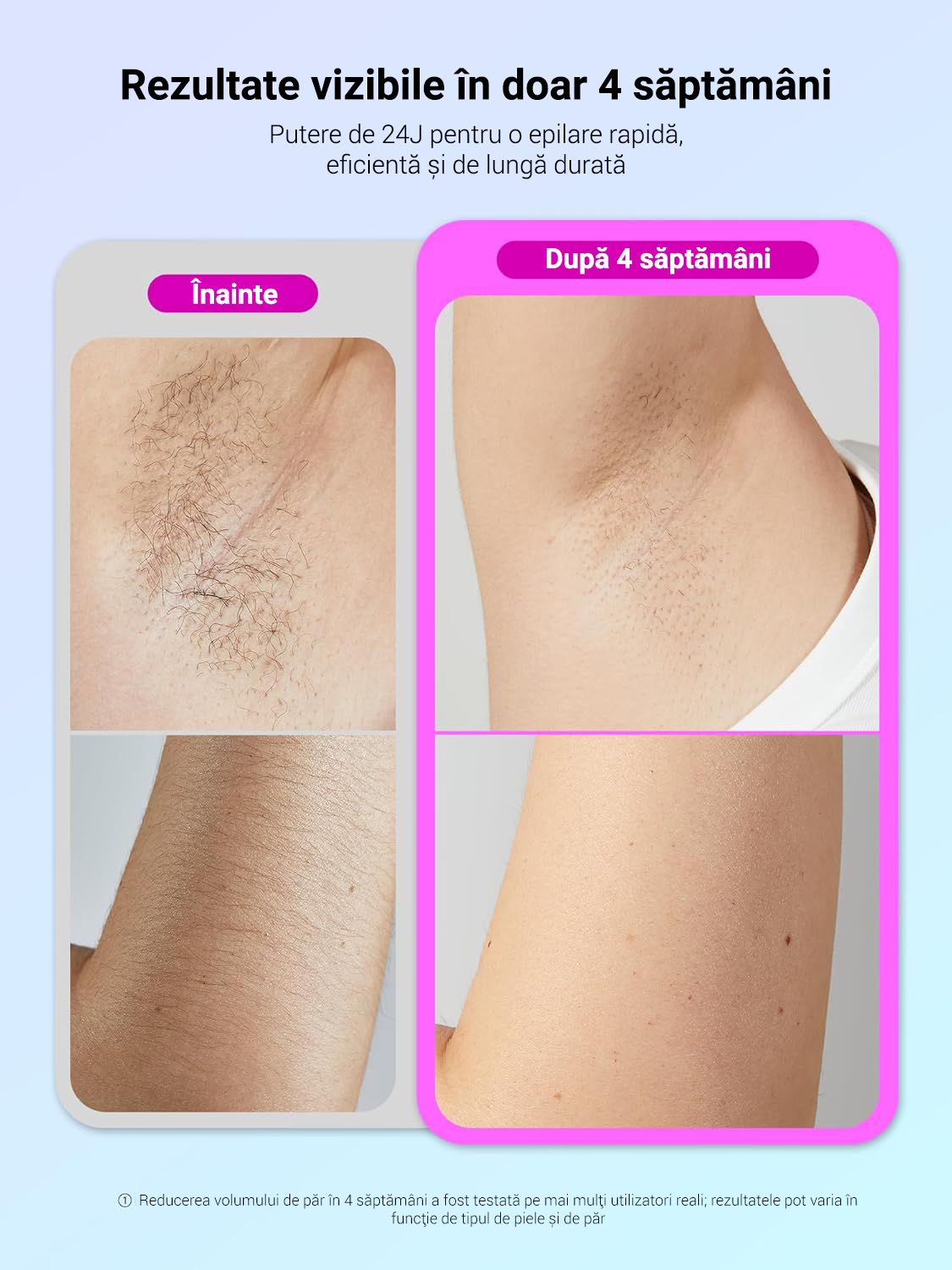 Epilator IPL Wavytalk